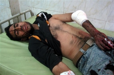 An injured Iraqi man lies at a hospital after a suicide car bomber crashed into an Iraqi police checkpoint, killing 33 and injuring 75 at an entrance to Sadr City, the capital's biggest Shiite Muslim neighborhood, in Baghdad, Iraq, Wednesday, April 18, 2007.